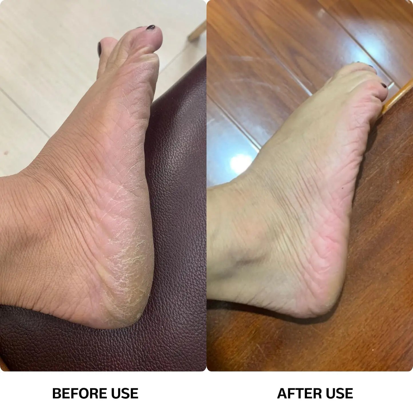 Electric Callus Remover with Speed Controller