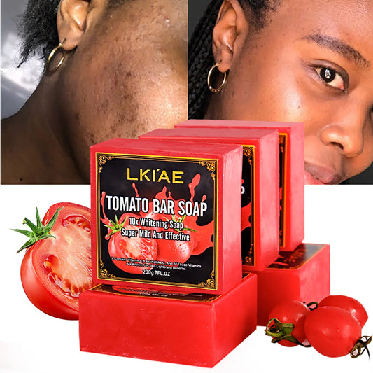 Organic Tomato Soap Bar, Lightening Skin, Deeply Clean, Exfoliate, Remove Dark Spots, Moisturizing,
